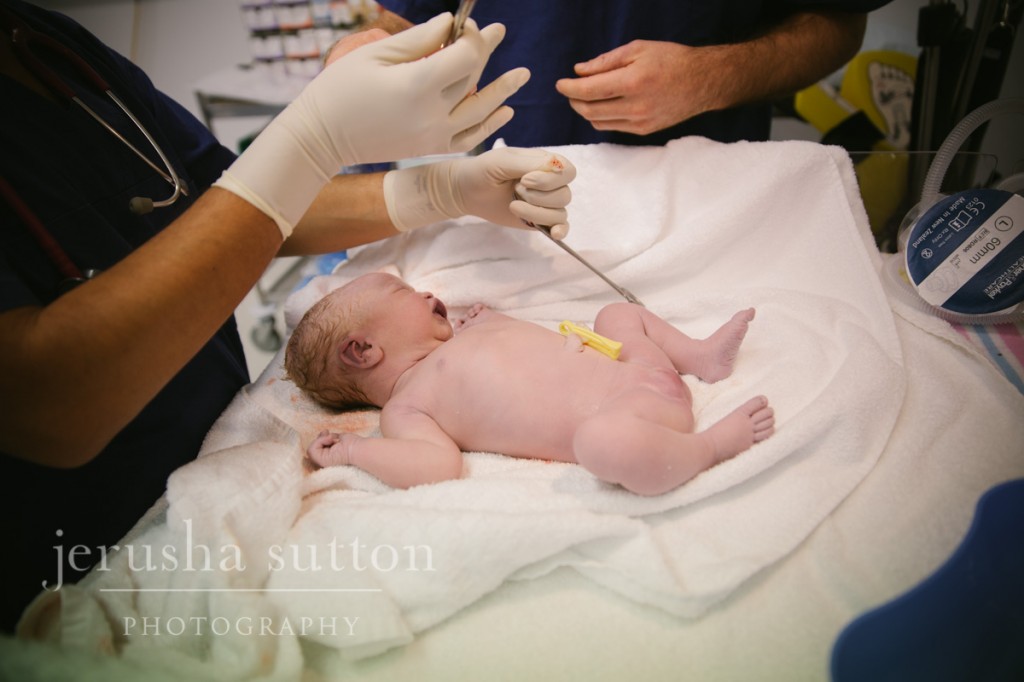 caesarean birth Sydney www.jerusha.com.au