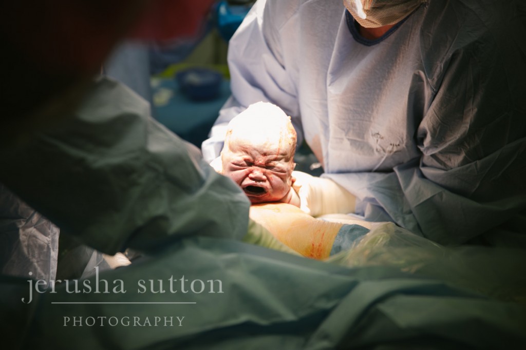 caesarean birth Sydney www.jerusha.com.au