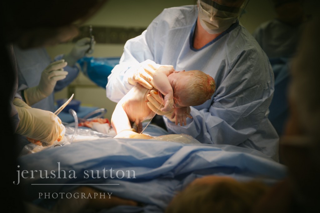 caesarean birth Sydney www.jerusha.com.au