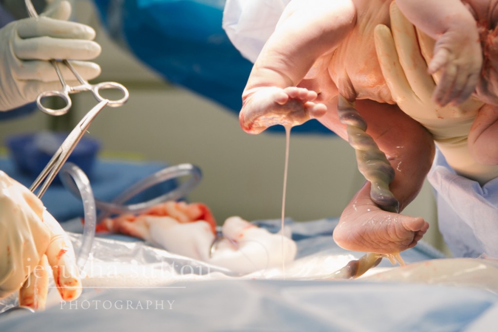 caesarean birth Sydney www.jerusha.com.au