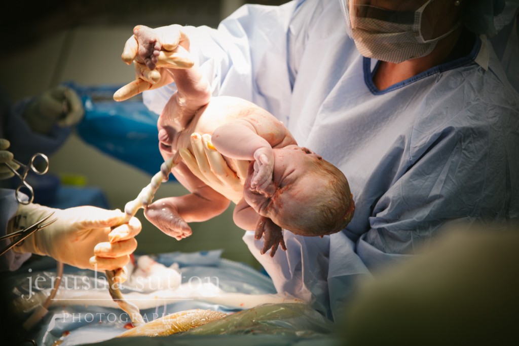 caesarean birth Sydney www.jerusha.com.au