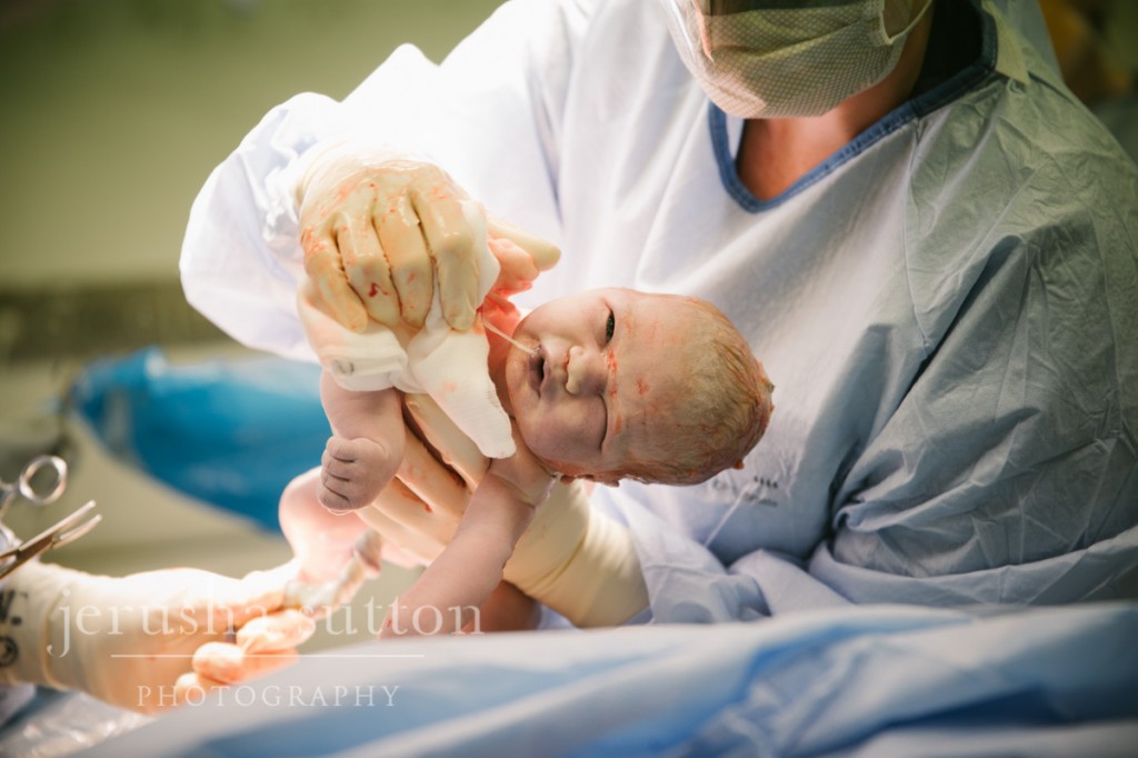 caesarean birth Sydney www.jerusha.com.au
