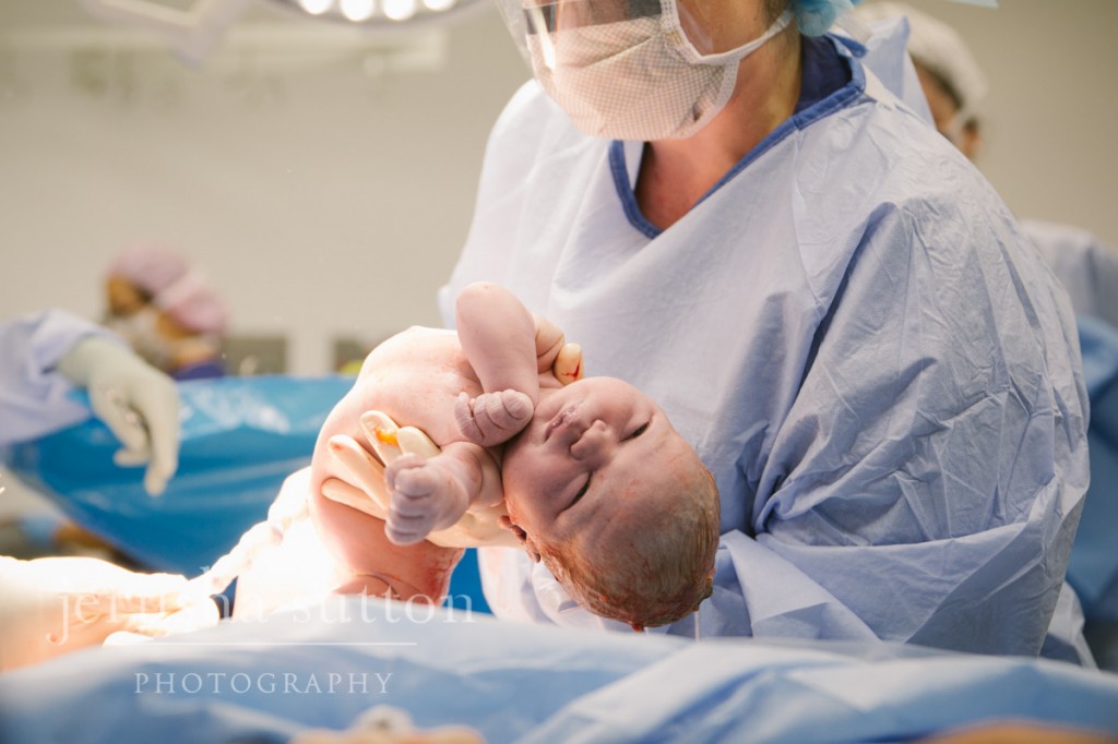 caesarean birth Sydney www.jerusha.com.au