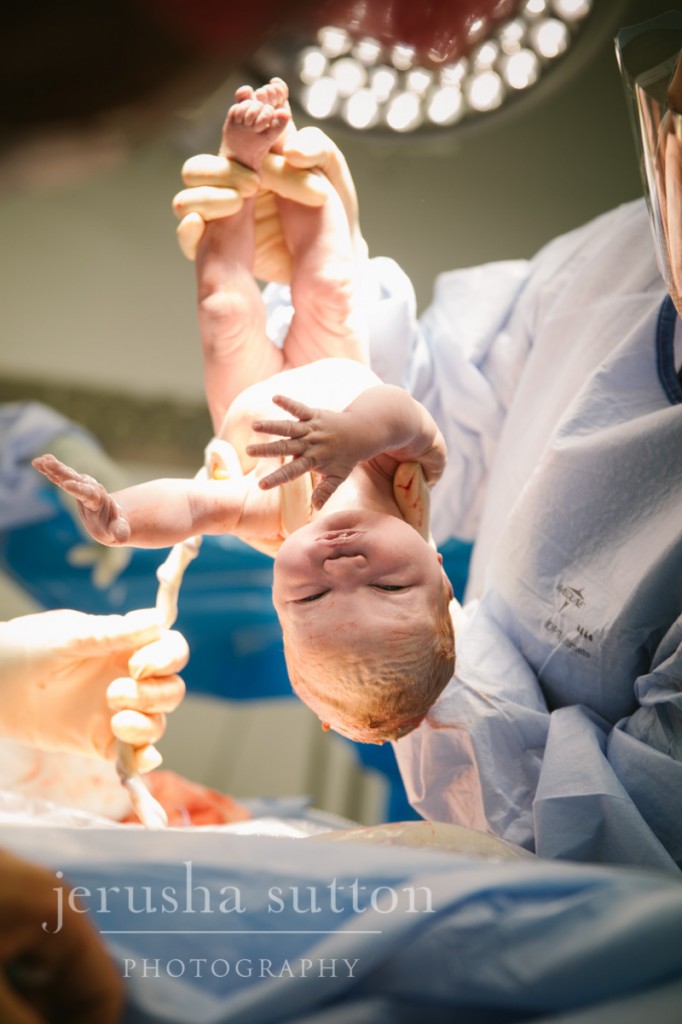 caesarean birth Sydney www.jerusha.com.au