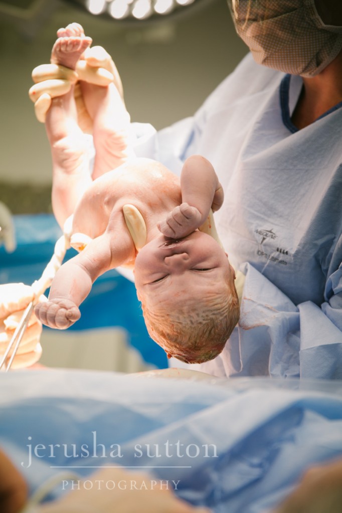 caesarean birth Sydney www.jerusha.com.au